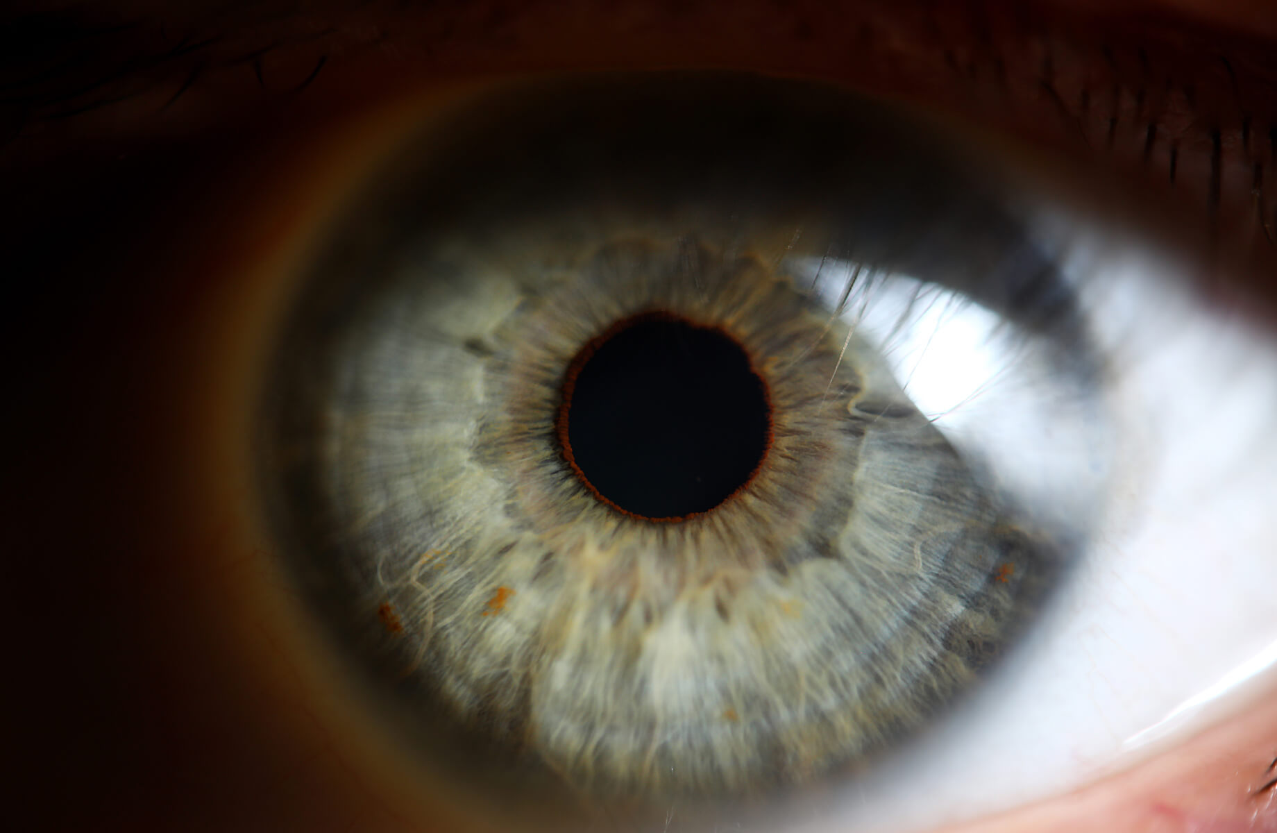 Irisdiagnostika - oči jako zdcadlo zdraví Irisdiagnostika - oči jako zdcadlo zdraví